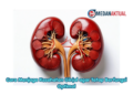 Cara Menjaga Kesehatan Ginjal agar Tetap Berfungsi Optimal