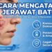 Cara Mengatasi Jerawat Batu Besar Meradang Yang Nyeri Dan Membandel